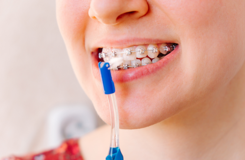 Tips For Adults With Braces